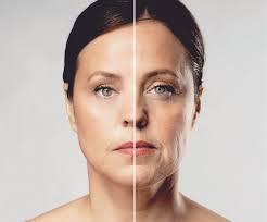 Lifting Visage Tunisie